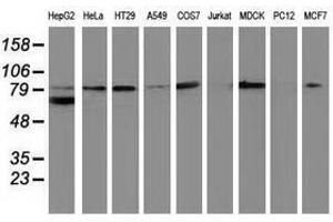 Image no. 2 for anti-Catenin (Cadherin-Associated Protein), beta 1, 88kDa (CTNNB1) antibody (ABIN1496896) (CTNNB1 anticorps)
