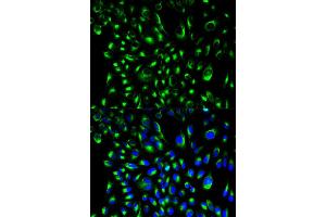 Immunofluorescence (IF) image for anti-Lymphocyte Cytosolic Protein 2 (SH2 Domain Containing Leukocyte Protein of 76kDa) (LCP2) antibody (ABIN1873525) (LCP2 anticorps)