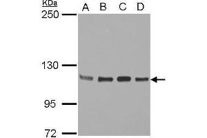 WB Image Sample (30 ug of whole cell lysate) A: Jurkat B: Raji C: K562 D: THP-1 5% SDS PAGE antibody diluted at 1:2000 (STAT2 anticorps  (C-Term))