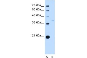 Western Blotting (WB) image for anti-Replication Factor C (Activator 1) 3, 38kDa (RFC3) antibody (ABIN2462934) (RFC3 anticorps)