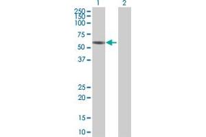 Lane 1: TRIM23 transfected lysate ( 64. (TRIM23 293T Cell Transient Overexpression Lysate(Denatured))