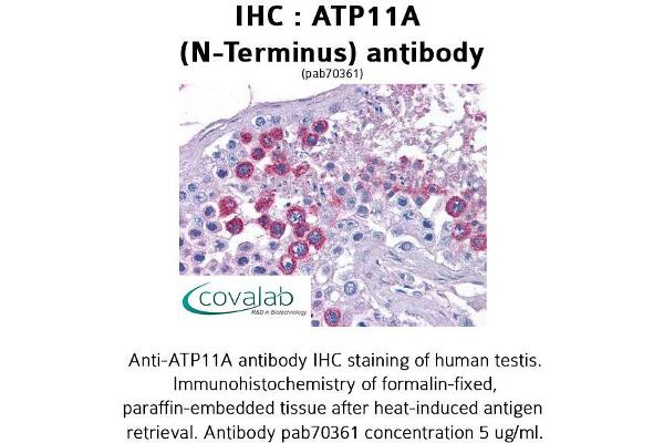 ATP11A anticorps  (N-Term)