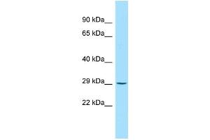 Host: Rabbit Target Name: Myf5 Sample Type: Rat Pancreas lysates Antibody Dilution: 1. (MYF5 anticorps  (Middle Region))