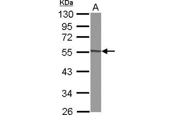 GTDC1 anticorps  (AA 1-204)