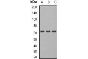 Western blot analysis of PGM1 expression in HepG2 (A), mouse heart (B), rat liver (C) whole cell lysates. (Phosphoglucomutase 1 anticorps)