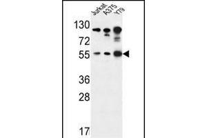 AKT1- antibody j western blot analysis in Jurkat,,Y79 cell line lysates (35 μg/lane). (AKT1 anticorps  (AA 107-135))