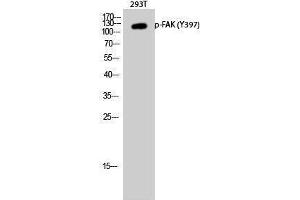 Western Blotting (WB) image for anti-PTK2 Protein tyrosine Kinase 2 (PTK2) (pTyr397) antibody (ABIN3179687) (FAK anticorps  (pTyr397))