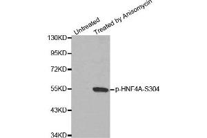 Western Blotting (WB) image for anti-Hepatocyte Nuclear Factor 4, alpha (HNF4A) (pSer304) antibody (ABIN1870237) (HNF4A anticorps  (pSer304))