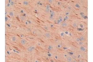 DAB staining on IHC-P; Samples: Rat Cerebrum Tissue (MEPE anticorps  (AA 28-224))