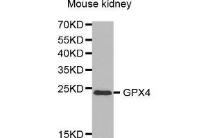 Western Blotting (WB) image for anti-Glutathione Peroxidase 4 (GPX4) (AA 30-197) antibody (ABIN6219078) (GPX4 anticorps  (AA 30-197))