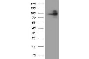 HEK293T cells were transfected with the pCMV6-ENTRY control (Left lane) or pCMV6-ENTRY FOLH1 (Right lane) cDNA for 48 hrs and lysed. (PSMA anticorps)