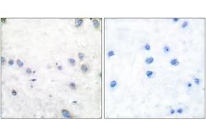 Immunohistochemistry analysis of paraffin-embedded human brain, using COT (Phospho-Thr290) Antibody. (CROT anticorps  (pThr290))