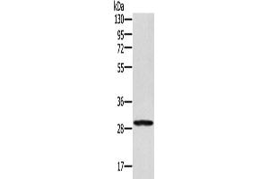 Western Blotting (WB) image for anti-Ectodysplasin A2 Receptor (EDA2R) antibody (ABIN2429982) (Ectodysplasin A2 Receptor anticorps)