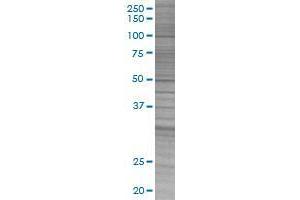 PPP1R1B transfected lysate. (PPP1R1B 293T Cell Transient Overexpression Lysate(Denatured))