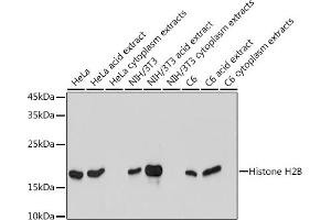 Western blot analysis of extracts of various cell lines, using Histone H2B antibody (ABIN7267736) at 1:1000 dilution. (HIST1H2BK anticorps)