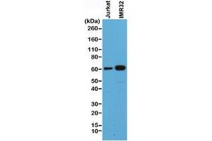Western blot of human Jurkat and IMR32 cell lysate using recombinant SMAD4 antibody at 1:500. (Recombinant SMAD4 anticorps  (C-Term))