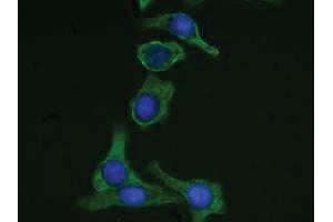 Human pancreatic carcinoma cell line MIA PaCa-2 was stained with Mouse Anti-Cytokeratin 19-FITC followed by DAPI. (Cytokeratin 19 anticorps  (C-Term) (FITC))