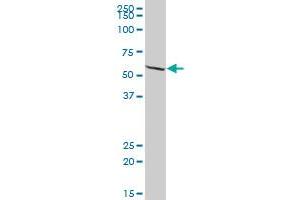 EPHX2 MaxPab polyclonal antibody. (EPHX2 anticorps  (AA 1-555))