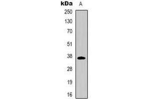 Western blot analysis of CD7 expression in Jurkat (A) whole cell lysates. (CD7 anticorps)