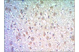 Immunohistochemical analysis of paraffin-embedded human brain tissues using KLHL21 mouse mAb with DAB staining. (KLHL21 anticorps)