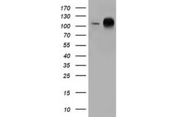 TACC3 anticorps