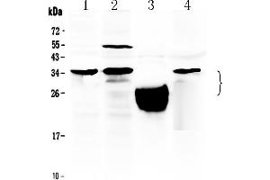 Western blot analysis of TFPI2 using anti- TFPI2 antibody . (TFPI2 anticorps  (N-Term))