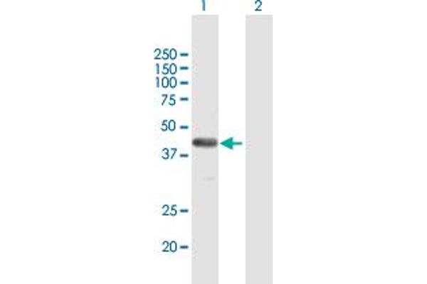 FAM62B anticorps  (AA 1-358)