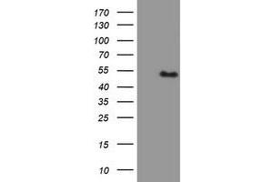 HEK293T cells were transfected with the pCMV6-ENTRY control (Left lane) or pCMV6-ENTRY PBX1 (Right lane) cDNA for 48 hrs and lysed. (PBX1 anticorps)