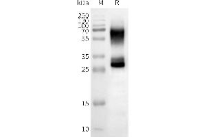 WB analysis of Human OR2B3-Nanodisc with anti-Flag monoclonal antibody at 1/5000 dilution, followed by Goat Anti-Rabbit IgG HRP at 1/5000 dilution (OR2B3 Protéine)