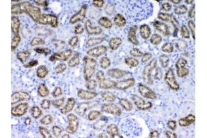 IHC analysis of RBP4 using anti-RBP4 antibody . (RBP4 anticorps  (AA 19-201))