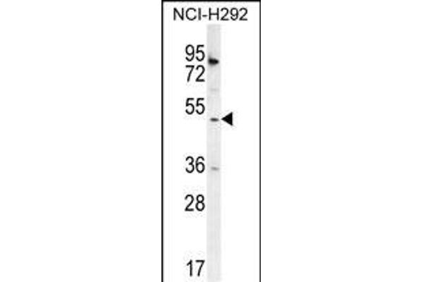 SH2D4A anticorps  (N-Term)