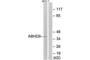 Western Blotting (WB) image for anti-Epoxide Hydrolase 3 (EPHX3) (AA 101-150) antibody (ABIN2890086) (ABHD9 anticorps  (AA 101-150))