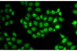 Immunofluorescence analysis of U2OS cells using EWSR1 Polyclonal Antibody (EWSR1 anticorps)