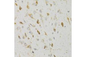 Immunohistochemistry of paraffin-embedded rat brain using KISS1R Antibody (ABIN5971525) at dilution of 1/100 (40x lens). (KISS1R anticorps)