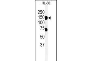 Western blot analysis of T131L Antibody (C-term) (ABIN651155 and ABIN2840102) in HL-60 cell line lysates (35 μg/lane). (TMEM131L anticorps  (C-Term))
