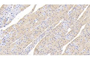 Detection of TGFb1 in Human Cardiac Muscle Tissue using Polyclonal Antibody to Transforming Growth Factor Beta 1 (TGFb1) (TGFB1 anticorps  (AA 279-390))