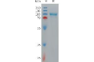 Cynomolgus CD93 Protein, His Tag on SDS-PAGE under reducing condition. (CD93 Protein (CD93) (AA 24-581) (His tag))