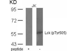 Image no. 1 for anti-Lymphocyte-Specific Protein tyrosine Kinase (LCK) (pTyr505) antibody (ABIN401553) (LCK anticorps  (pTyr505))