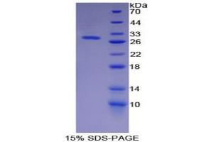 SDS-PAGE analysis of Pig Insulin Like Growth Factor Binding Protein 4 (IGFBP4) Protein. (IGFBP4 Protéine)