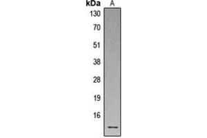 Western blot analysis of Defensin alpha 1 expression in human spleen (A) whole cell lysates. (alpha Defensin 1 anticorps  (Center))