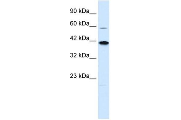 KCNK13 anticorps  (C-Term)