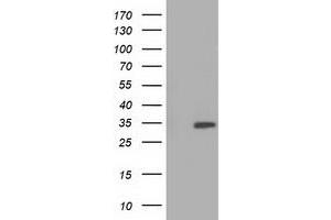 Western Blotting (WB) image for anti-Sulfotransferase Family, Cytosolic, 2A, Dehydroepiandrosterone (DHEA)-Preferring, Member 1 (SULT2A1) antibody (ABIN1501239) (SULT2A1 anticorps)