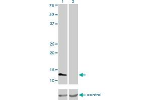 Western blot analysis of FABP3 over-expressed 293 cell line, cotransfected with FABP3 Validated Chimera RNAi (Lane 2) or non-transfected control (Lane 1). (FABP3 anticorps  (AA 1-133))