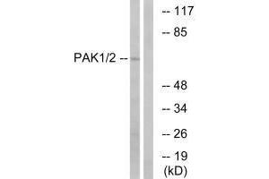Western blot analysis of extracts from K562 cells, using PAK1/2 (Ab-199) antibody. (PAK1 anticorps  (Ser199))