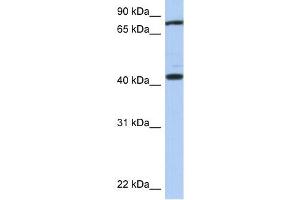 TEX9 antibody used at 1 ug/ml to detect target protein. (TEX9 anticorps  (Middle Region))