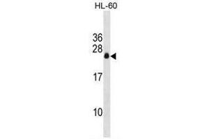 APRG1 Antibody (Center) western blot analysis in HL-60 cell line lysates (35µg/lane). (C3ORF35 anticorps  (Middle Region))
