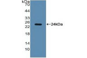 Detection of Recombinant NCL, Human using Polyclonal Antibody to Nucleolin (NCL) (Nucleolin anticorps  (AA 388-569))
