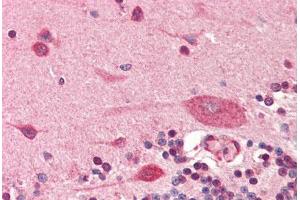 Human Brain, Cerebellum (formalin-fixed, paraffin-embedded) stained with PDPN antibody ABIN364350 at 5 ug/ml followed by biotinylated anti-mouse IgG secondary antibody ABIN481714, alkaline phosphatase-streptavidin and chromogen. (Podoplanin anticorps  (AA 1-206))