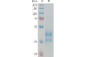 Human Protein, hFc Tag on SDS-PAGE under reducing condition. (CCL24 Protein (Fc Tag))