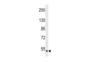 Western blot analysis in HepG2 cell line lysate (35ug/lane). (ZAK anticorps  (AA 271-300))